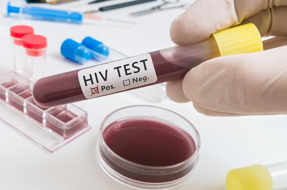 Confidential HIV Testing Services at MedicPlus Health Clinic
