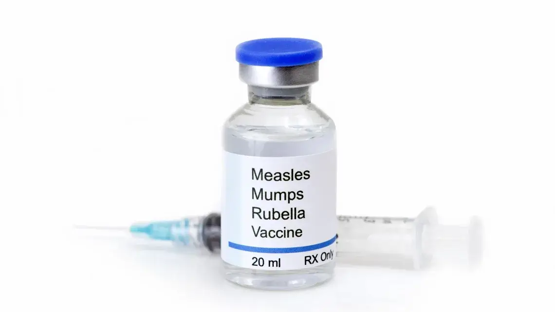 Happy child protected by MMR vaccination against mumps, measles, and rubella